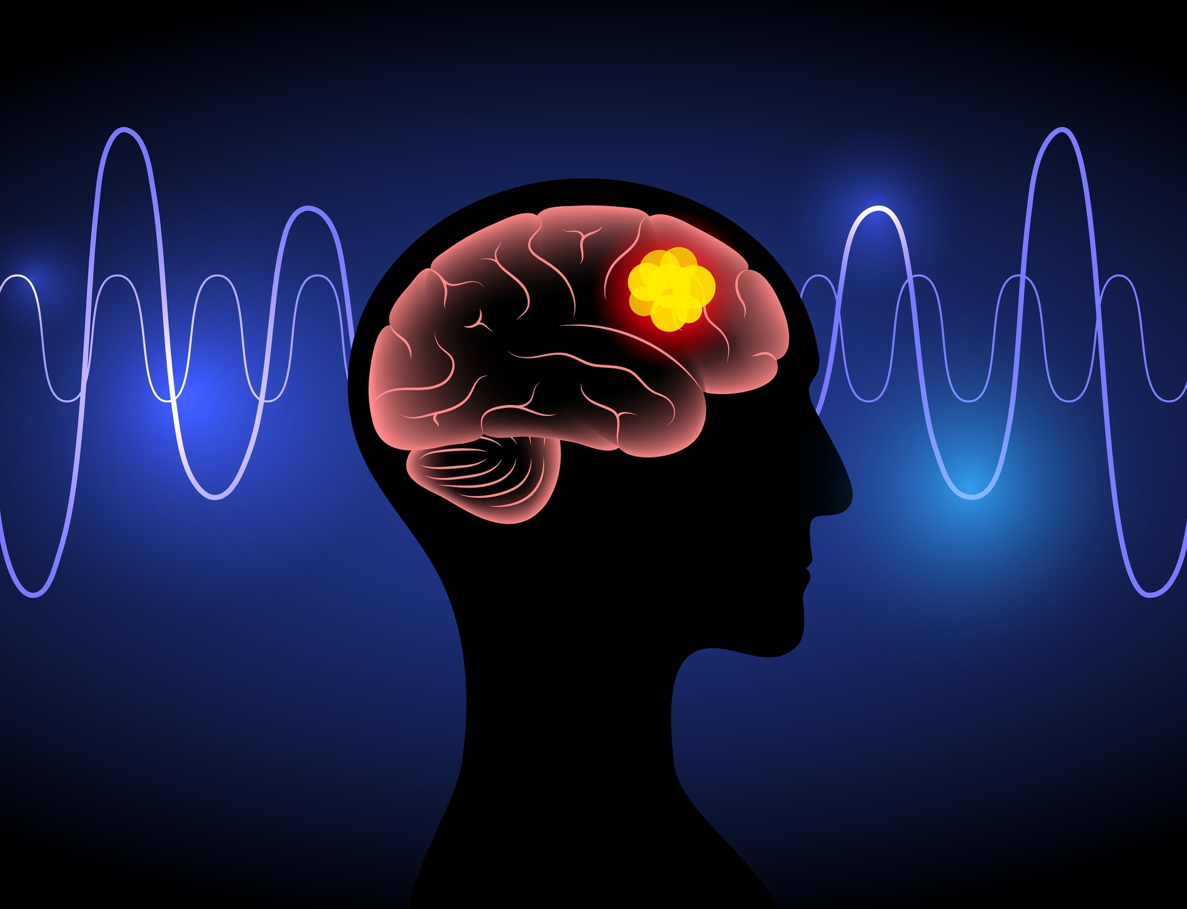 Az étrend megváltoztatása megkönnyítheti az agydaganat kezelését