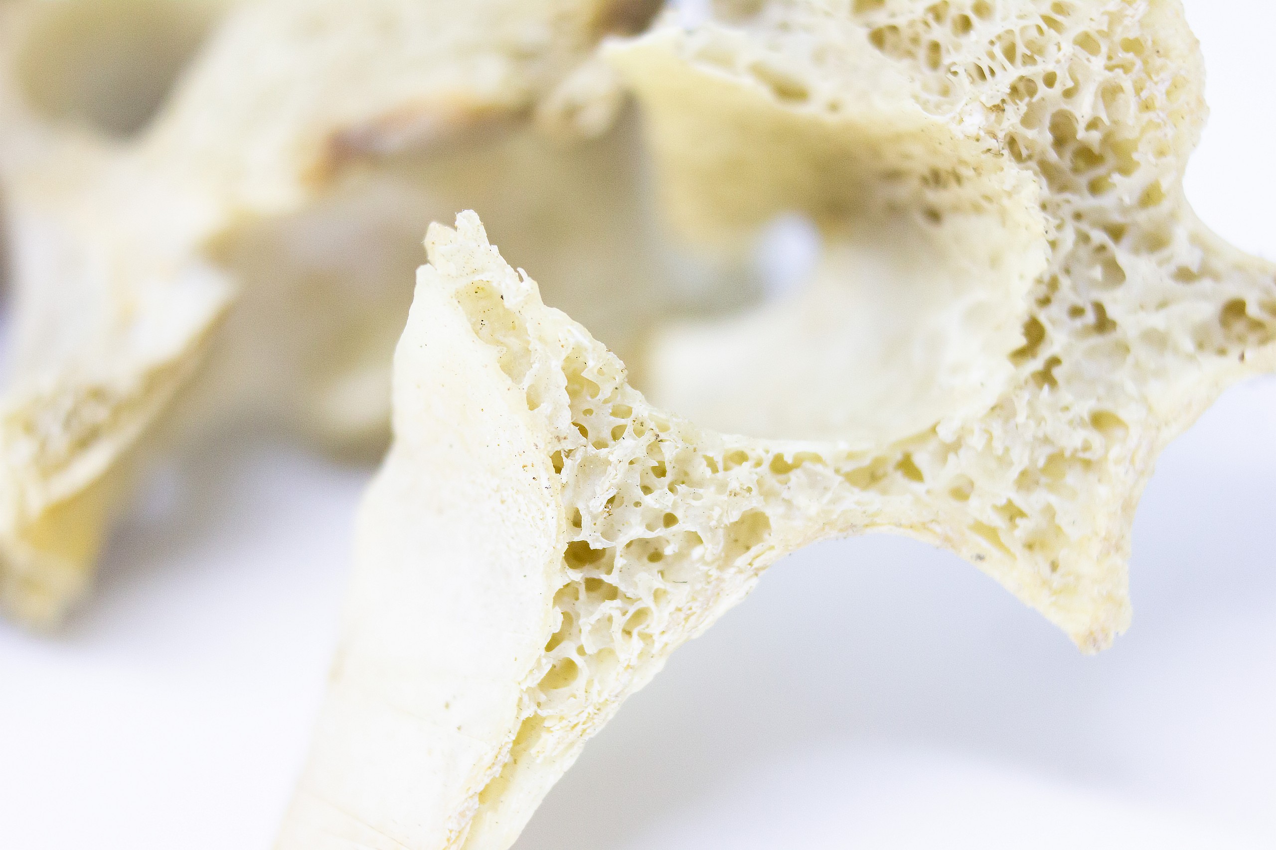 Hatalmas áttörés a csontritkulás-kutatásban, ami visszafordíthatja a folyamatot