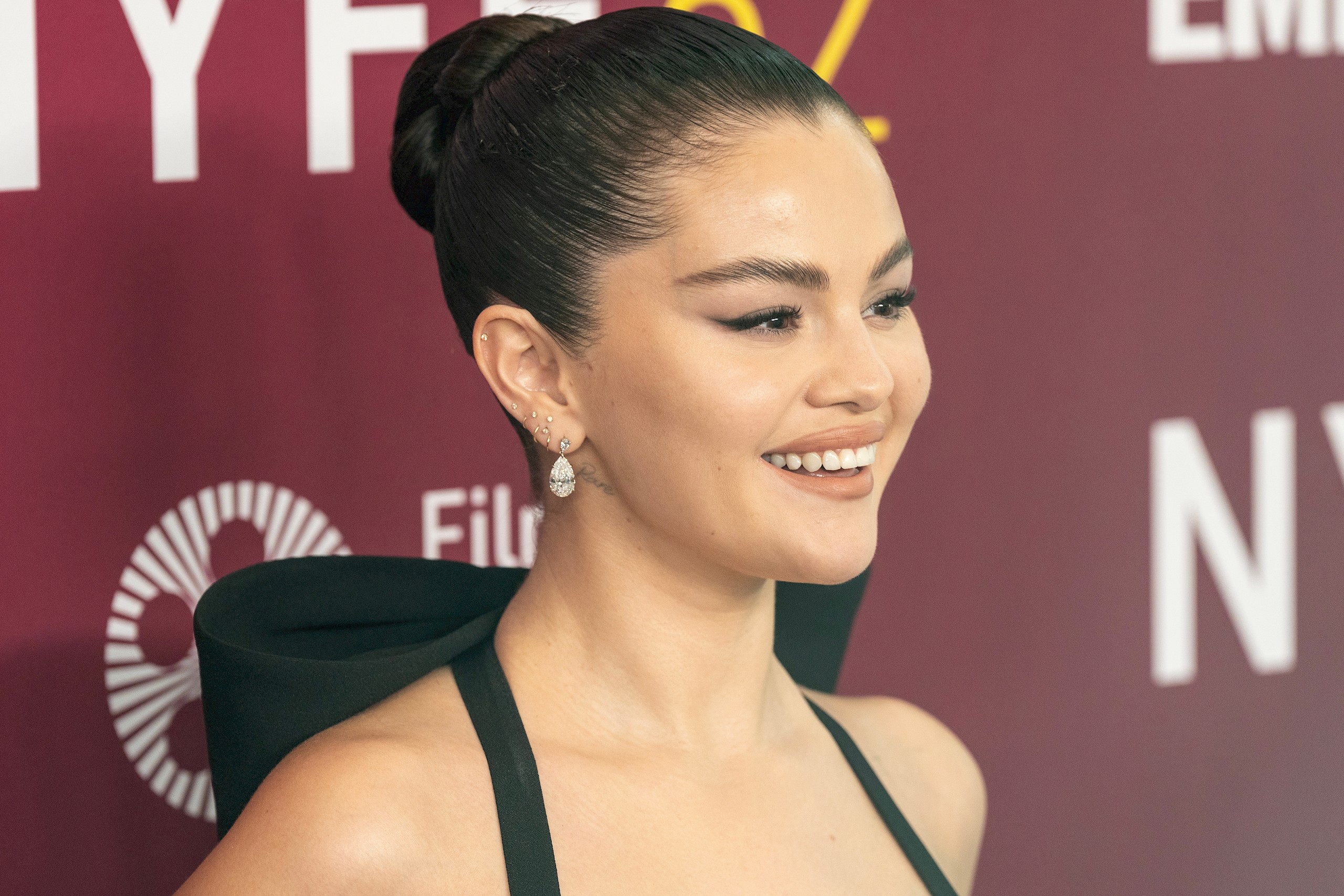 Selena Gomez elárulta, hogyan változott meg az élete a diagnózisa óta