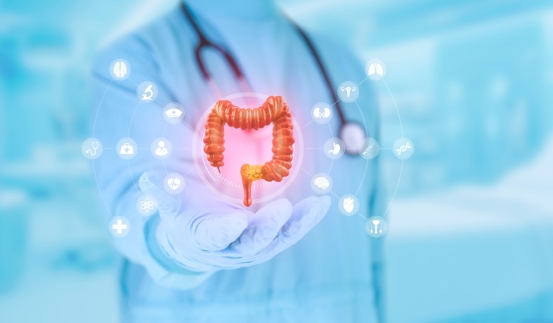 4 mód, amivel csökkentheted a vastagbélrák kockázatát